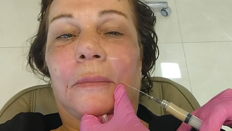 Mulher morre após procedimentos estéticos feitos por estudante de biomedicina investigado por exercício ilegal da medicina no Paraná