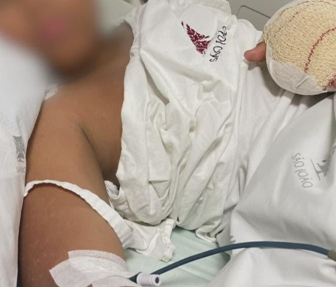 Portugal abre apuração após menino ter dedos amputados em agressão escolar