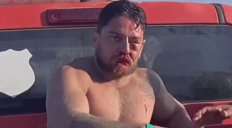 Discussão por valor de cadeiras termina em agressão a turistas em praia de Pernambuco