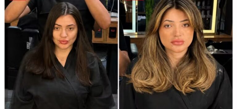 Antes e depois mostram resultado de cabelo antes de ataque contra cabeleireiro em SP