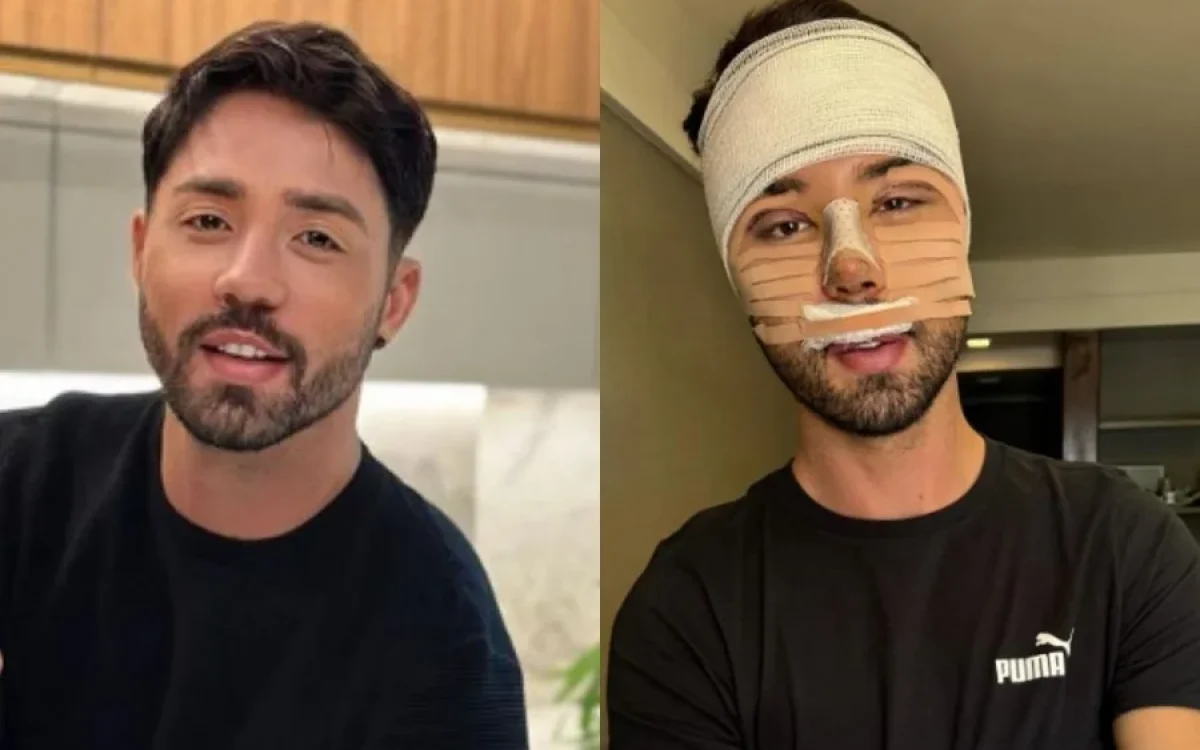 Influenciador Rico Melquiades detalha histórico de cirurgias e diz que seguirá com procedimentos